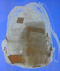 rayons_x.png